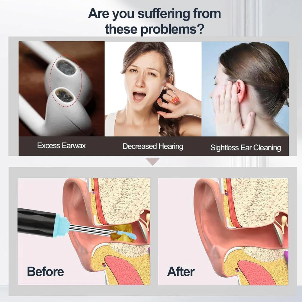 Visual Ear Wax Removal Tool